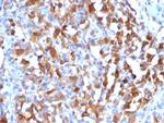 MART-1/Melan-A/MLANA (Melanoma Marker) Antibody in Immunohistochemistry (Paraffin) (IHC (P))