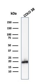 MART-1/Melan-A/MLANA (Melanoma Marker) Antibody in Western Blot (WB)