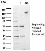 GRAMD4 (Transcription Factor) Antibody in SDS-PAGE (SDS-PAGE)