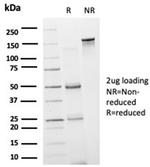 GRAMD4 (Transcription Factor) Antibody in Immunoelectrophoresis (IE)