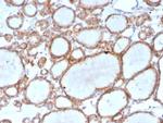 DBC2/RHOBTB2 Antibody in Immunohistochemistry (Paraffin) (IHC (P))