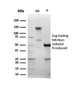 DBC2/RHOBTB2 Antibody in SDS-PAGE (SDS-PAGE)