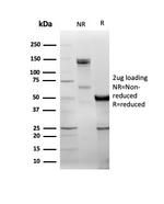 DBC2/RHOBTB2 Antibody in Immunoelectrophoresis (IE)