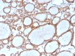 DBC2/RHOBTB2 Antibody in Immunohistochemistry (Paraffin) (IHC (P))