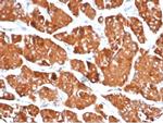 DBC2/RHOBTB2 Antibody in Immunohistochemistry (Paraffin) (IHC (P))