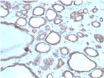 DBC2/RHOBTB2 Antibody in Immunohistochemistry (Paraffin) (IHC (P))