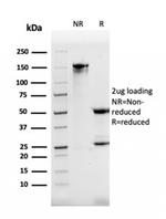 DBC2/RHOBTB2 Antibody in SDS-PAGE (SDS-PAGE)