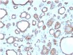 DBC2/RHOBTB2 Antibody in Immunohistochemistry (Paraffin) (IHC (P))