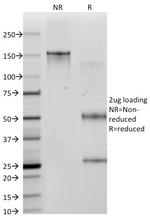 ICOS-L/ICOS Ligand/B7RP-1 (Immuno-Oncology Target) Antibody in SDS-PAGE (SDS-PAGE)