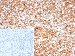 ICOS-L/ICOS Ligand/B7RP-1 (Immuno-Oncology Target) Antibody in Immunohistochemistry (Paraffin) (IHC (P))