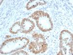 SATB2 (Colorectal Carcinoma Marker) Antibody in Immunohistochemistry (Paraffin) (IHC (P))