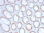 SATB2 (Colorectal Carcinoma Marker) Antibody in Immunohistochemistry (Paraffin) (IHC (P))