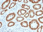 SATB2 (Colorectal Carcinoma Marker) Antibody in Immunohistochemistry (Paraffin) (IHC (P))