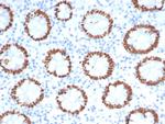 SATB2 (Colorectal Carcinoma Marker) Antibody in Immunohistochemistry (Paraffin) (IHC (P))