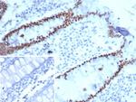 SATB2 (Colorectal Carcinoma Marker) Antibody in Immunohistochemistry (Paraffin) (IHC (P))