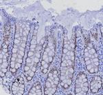 SATB2 (Colorectal Carcinoma Marker) Antibody in Immunohistochemistry (Paraffin) (IHC (P))