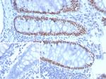 SATB2 (Colorectal Carcinoma Marker) Antibody in Immunohistochemistry (Paraffin) (IHC (P))