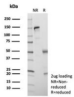 SATB2 (Colorectal Carcinoma Marker) Antibody in SDS-PAGE (SDS-PAGE)