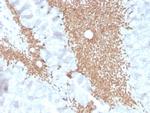 SATB2 Antibody in Immunohistochemistry (Paraffin) (IHC (P))