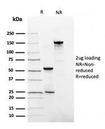 Fibronectin Antibody in SDS-PAGE (SDS-PAGE)