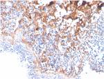 Fibronectin (Total) Antibody in Immunohistochemistry (Paraffin) (IHC (P))