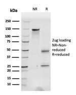 Fibronectin (Total) Antibody in SDS-PAGE (SDS-PAGE)