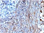 Fibronectin Antibody in Immunohistochemistry (Paraffin) (IHC (P))