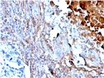 Fibronectin Antibody in Immunohistochemistry (Paraffin) (IHC (P))