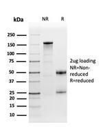 Fibronectin Antibody in SDS-PAGE (SDS-PAGE)