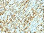 Fibronectin (8th Type III Repeat) Antibody in Immunohistochemistry (Paraffin) (IHC (P))