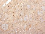 Fibronectin (Fibrin/Heparin-Binding Domain) Antibody in Immunohistochemistry (Paraffin) (IHC (P))