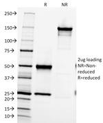 Fibronectin (Fibrin/Heparin-Binding Domain) Antibody in SDS-PAGE (SDS-PAGE)