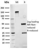 Fibronectin Antibody in SDS-PAGE (SDS-PAGE)