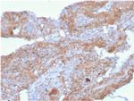 Fibronectin Antibody in Immunohistochemistry (Paraffin) (IHC (P))