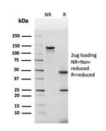 Fibronectin Antibody in SDS-PAGE (SDS-PAGE)