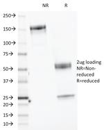 CELA3B/ELA3B (Pancreatic Function Marker) Antibody in SDS-PAGE (SDS-PAGE)