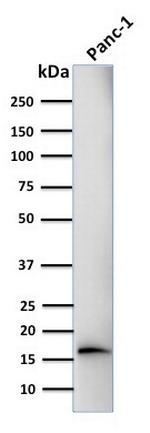 CELA3B/ELA3B (Pancreatic Function Marker) Antibody in Western Blot (WB)