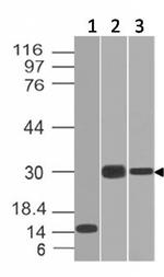 CELA3B/ELA3B (Pancreatic Function Marker) Antibody in Western Blot (WB)