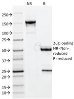 CELA3B/ELA3B (Pancreatic Function Marker) Antibody in SDS-PAGE (SDS-PAGE)