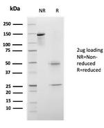 CELA3B/ELA3B Antibody in SDS-PAGE (SDS-PAGE)