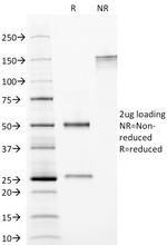 CELA3B/ELA3B (Pancreatic Function Marker) Antibody in SDS-PAGE (SDS-PAGE)