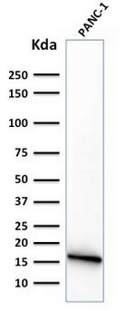 CELA3B/ELA3B (Pancreatic Function Marker) Antibody in Western Blot (WB)