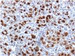 CELA3B/ELA3B Antibody in Immunohistochemistry (Paraffin) (IHC (P))