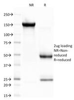 CELA3B/ELA3B Antibody in SDS-PAGE (SDS-PAGE)