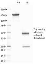 CELA3B/ELA3B (Pancreatic Function Marker) Antibody in SDS-PAGE (SDS-PAGE)