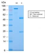 CELA3B/ELA3B (Pancreatic Function Marker) Antibody in SDS-PAGE (SDS-PAGE)