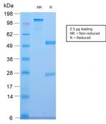 CELA3B/ELA3B (Pancreatic Function Marker) Antibody in SDS-PAGE (SDS-PAGE)