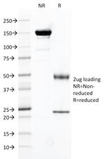 FOLH1/PSMA (Prostate Epithelial Marker) Antibody in SDS-PAGE (SDS-PAGE)