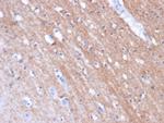 FOLH1/PSMA (Prostate Epithelial Marker) Antibody in Immunohistochemistry (Paraffin) (IHC (P))