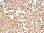 PRAME nuclear receptor transcriptional regulator Antibody in Immunohistochemistry (Paraffin) (IHC (P))